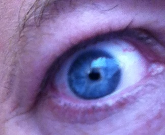 Eye